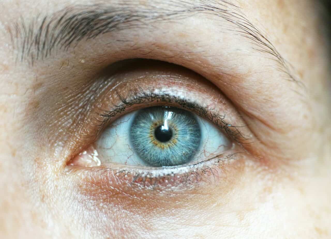 cataracts
