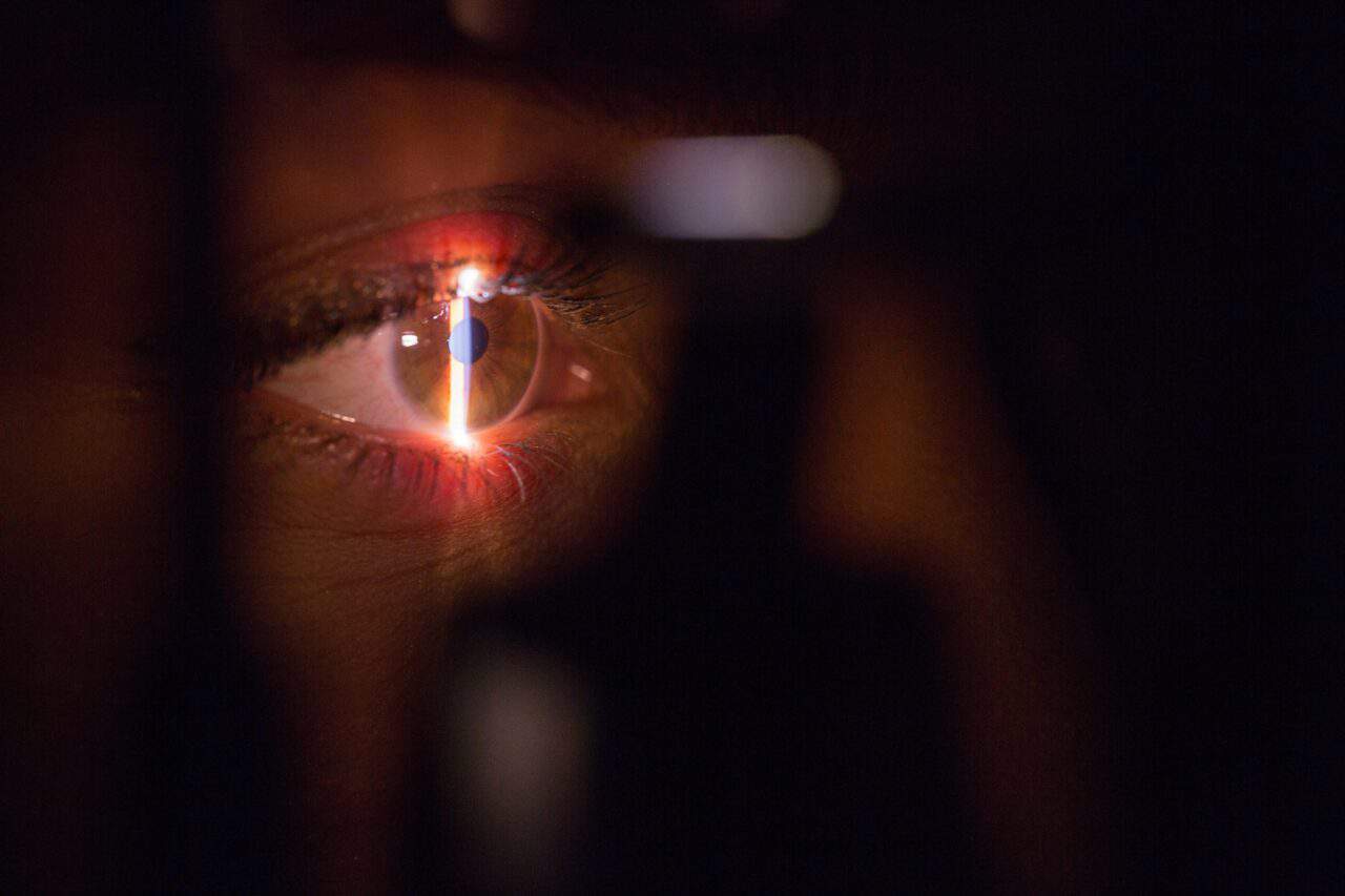 lasik