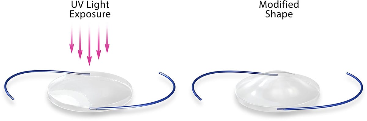 Cataract lens