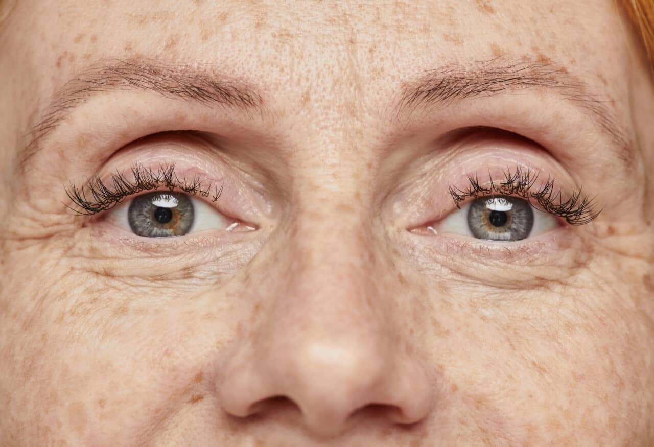 cornea transplants