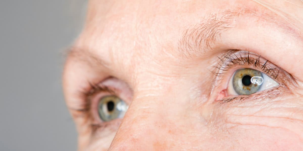 woman with cataracts