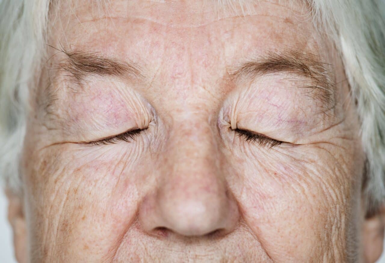 dry eyes after cataract surgery