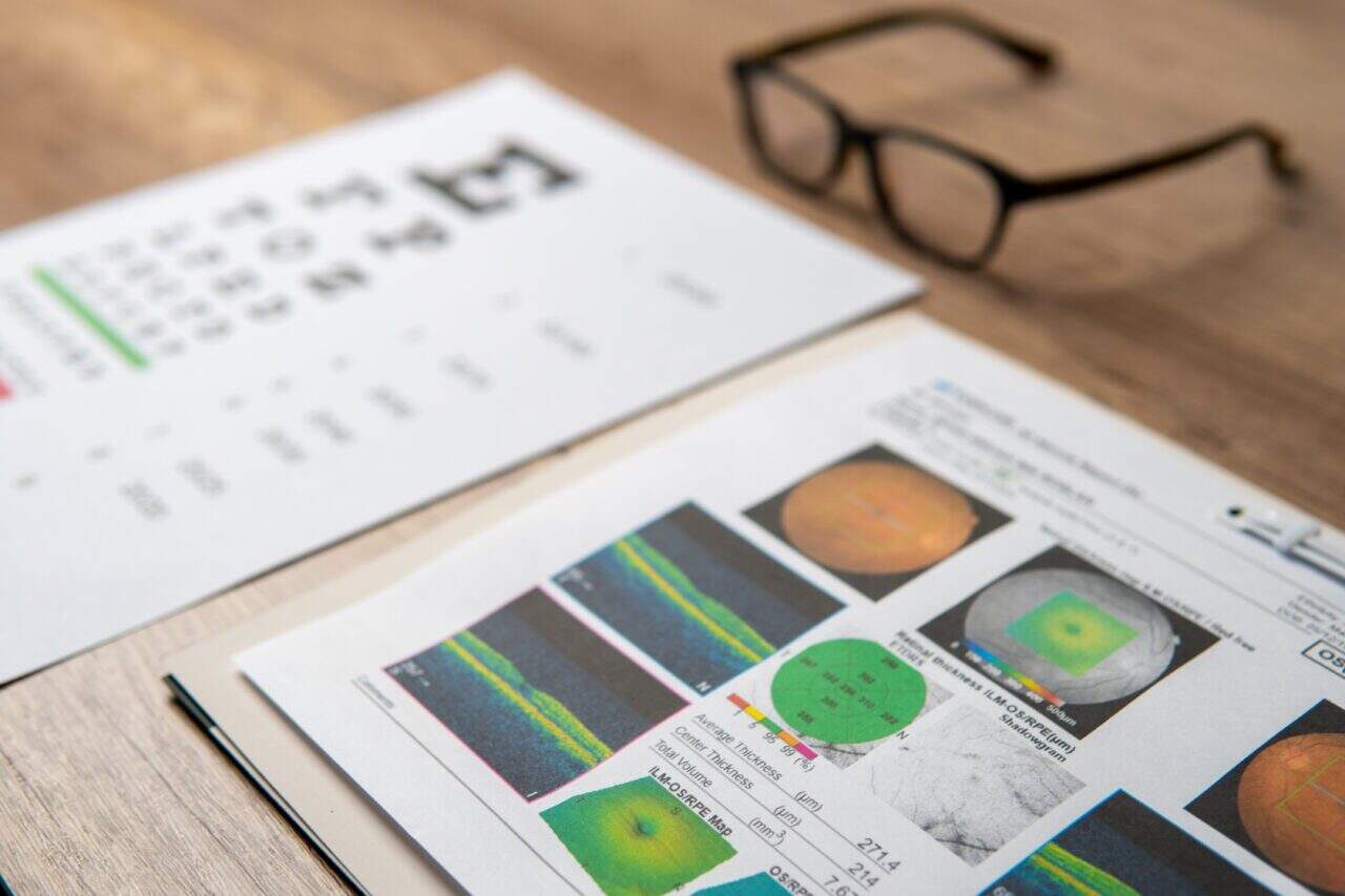 myths about macular degeneration