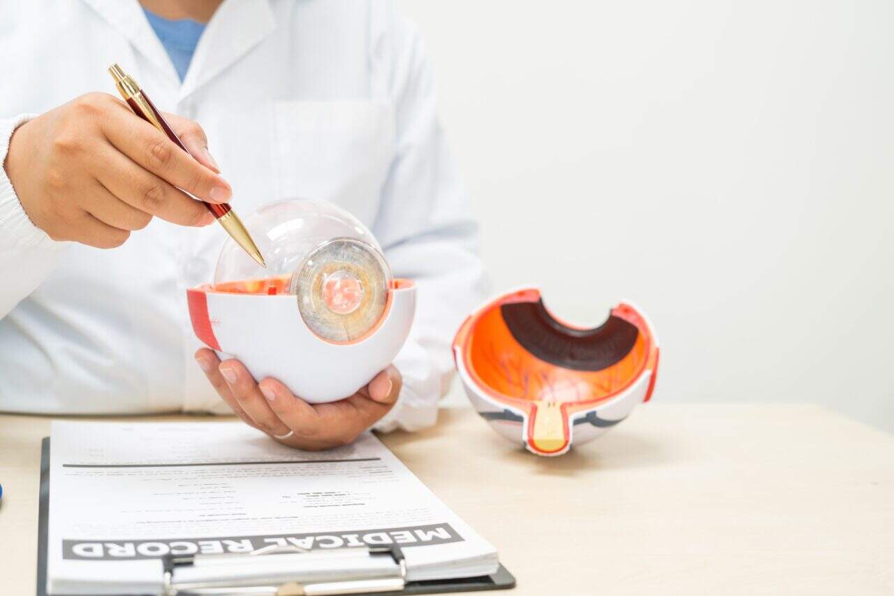 posterior capsular opacification