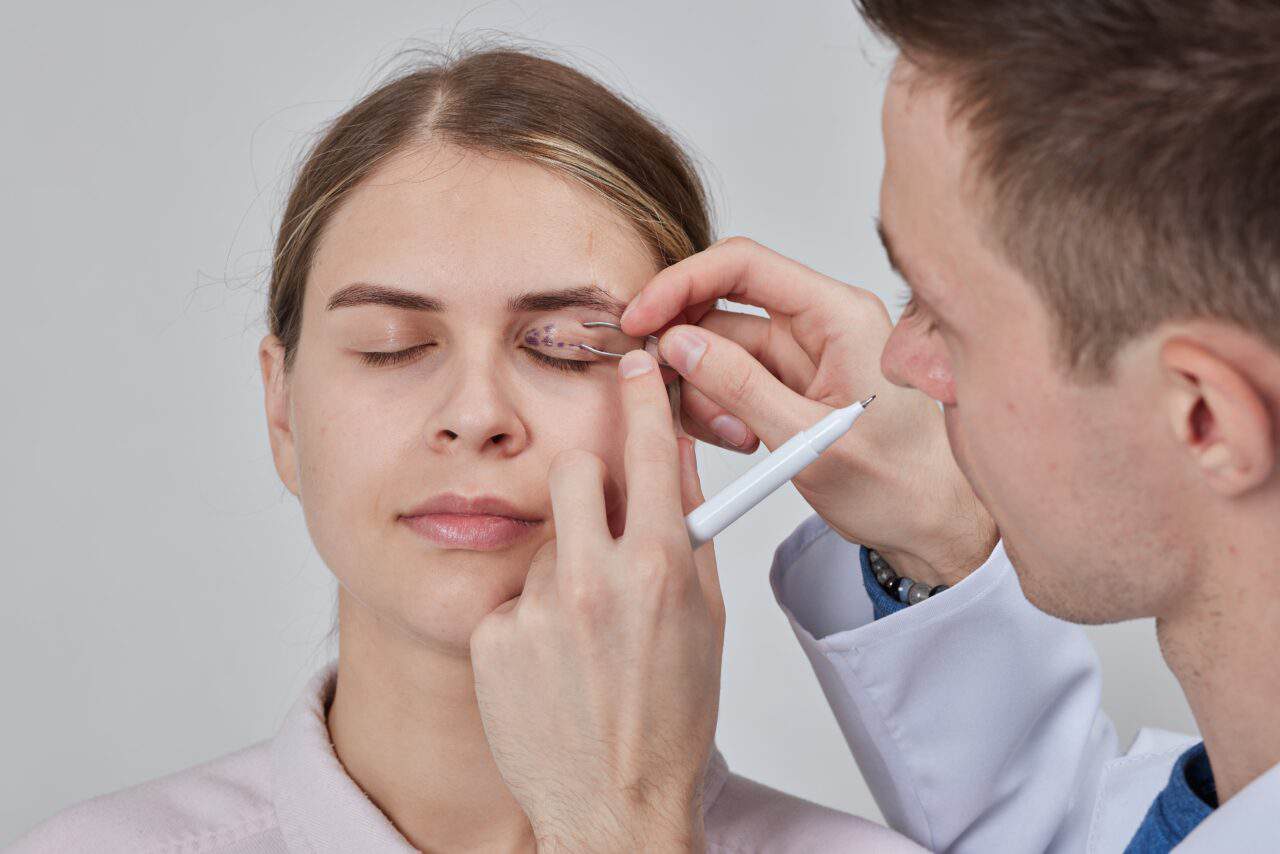 signs you may need blepharoplasty
