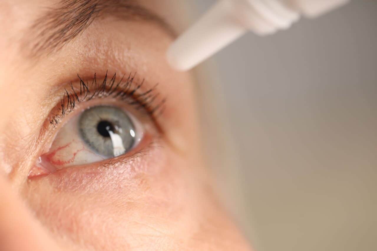putting eye drops in an eye